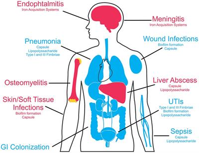 Animal models of Klebsiella pneumoniae mucosal infections